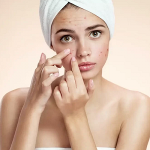 Acne Treatment Clinic in Oman