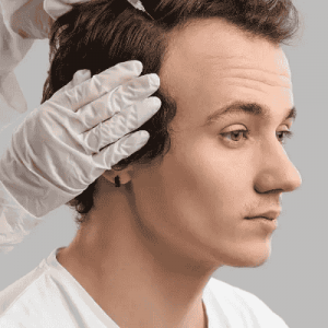 FUT Hair Transplant in Muscat