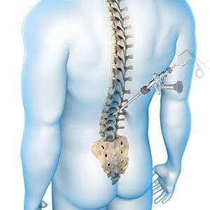 How to Keep Your Spine Aligned: Tips for a Healthy Back