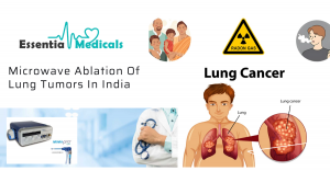 Understanding the Microwave Treatment Option for Lung Tumors
