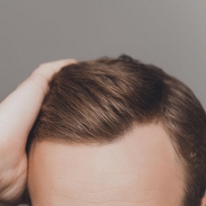 Best FUT Hair Transplant Clinic in Muscat