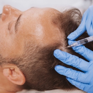 Best FUT Hair Transplant Clinic in Oman