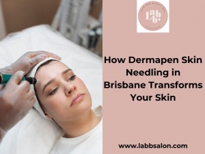 How Dermapen Skin Needling in Brisbane Transforms Your Skin