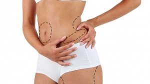 Liposuction in Dubai Understanding the Procedure and Its Benefits