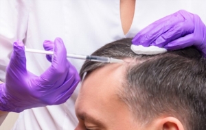 PRP Hair Treatment in Pune