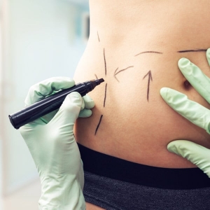 How Liposuction Shapes Your Confidence