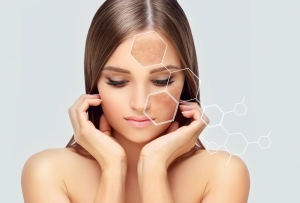 Hyperpigmentation Treatment