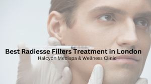 Radiesse Fillers Treatment