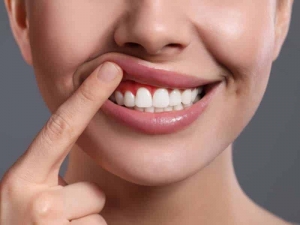 Pros and Cons of Gum Recession
