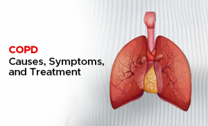 Understanding COPD Stages and Tailored Treatments for Each Stage