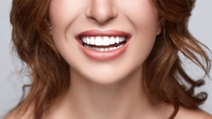 Hollywood Smile Design: Your Journey to a Confident, Radiant Smile