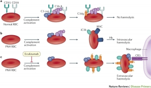 Paroxysmal Nocturnal Hemoglobinuria Market Size, Industry Trends, Growth 2024-34