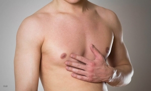 Looking for Gynecomastia Solutions? Here’s What to Know
