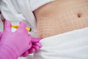 Navigating the World of Fat Melting Injections: A Dubai Guide