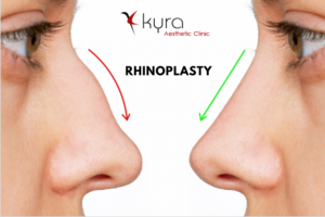 Finding the Best Rhinoplasty Surgeon in Ludhiana