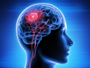 Does Brain Tumor Cause Death?