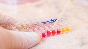 Mycoplasma Testing : Ensuring Product Safety and Efficacy Pharmaceutical Company Announces New Quality Control Measures