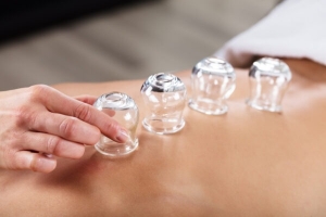 Discover the Advantages of Cupping Therapy in Royal Oak