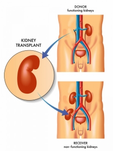 Nephrologist in India: How to Choose the Right Specialist for Your Kidney Health