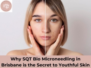 Why SQT Bio Microneedling in Brisbane is the Secret to Youthful Skin