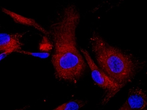 Mesenchymal Stem Cells: Understanding Their Function and Potential for Disease Treatment