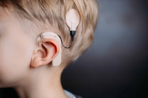 Cochlear Implants Market: A Growing Demand for Hearing Solutions