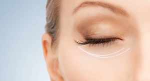 How Does Botox Smooth Fine Lines Around the Eyes?