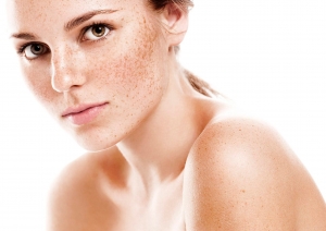 How Effective Are Laser Treatments for Melasma in Islamabad?