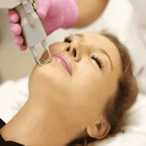 Best Laser Treatments Oman