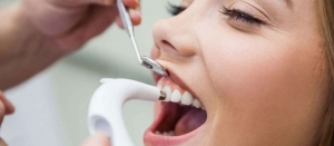 Brighter Smiles, Bigger Confidence: Teeth Whitening Trends in Dubai
