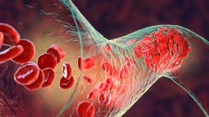 Natural Blood Thinners and Holistic Artery Health: Reducing Blood Clot and Plaque Risks