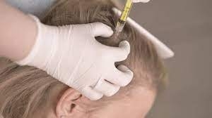 Hair Botox for Frizzy Hair: How It Works and Why It’s So Effective