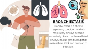 Comprehensive Guide to Bronchiectasis Treatment in Delhi