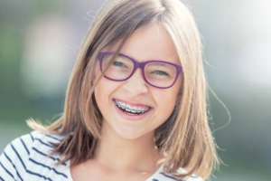 Traditional Braces for Children: Benefits, Process, and Care Tips