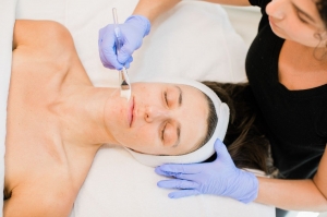 Unlock a New You with Chemical Peels