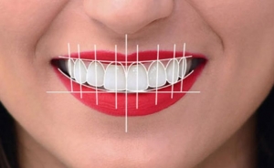 Transforming Patient Experiences with Digital Smile Design Solutions
