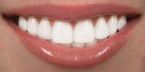 The Science Behind Teeth Whitening: How It Really Works
