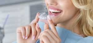 From Consultation to Perfect Smile: Your Journey with Aligners