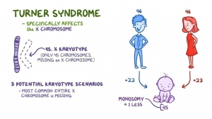 Turner Syndrome Market Growth Analysis, Size, Share, Report 2024-34