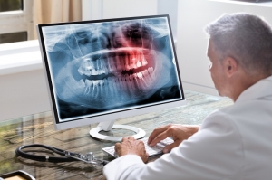 Are Dental Panoramic X-Rays Safe Insights for Dubai Patients