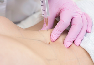 Revitalize Your Body Fat Melting Injections in Dubai Demystified