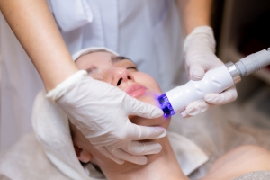 Targeting Acne and Skin Rejuvenation with Fotona 4D Laser Therapy in Dubai