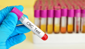 Who Should Get a CBC Test Done? Key Signs and Symptoms
