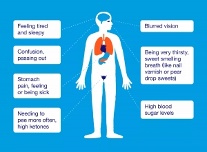 Diabetic Ketoacidosis Market Share, Industry Trends, Forecast 2024-34