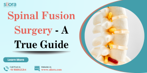 Spinal Fusion Surgery - A True Guide