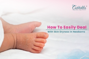 How To Easily Deal With Skin Dryness in Newborns
