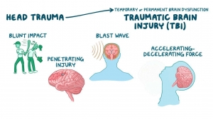 Traumatic Brain Injury Market Size, Share, Trends, Industry Report 2024-34