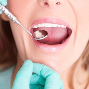 Dubai’s finest cosmetic dentistry for flawless results