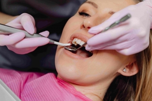The Future of Fillings Composite Dental Solutions in Dubai