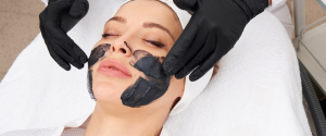 When Is the Best Time to Use Spectra Laser Carbon Peel?